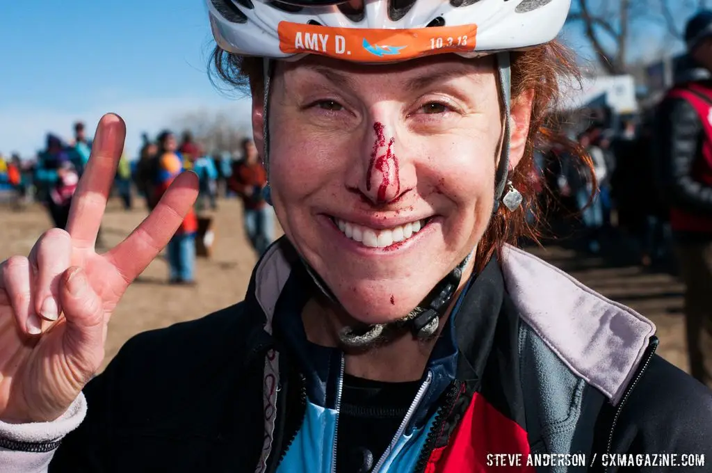 Post-race Elite Women 2014 USA Cyclocross Nationals. © Steve Anderson