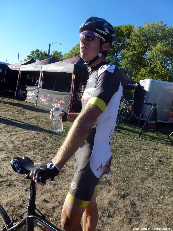 Brad White shows off injuries post-race. © Cyclocross Magazine