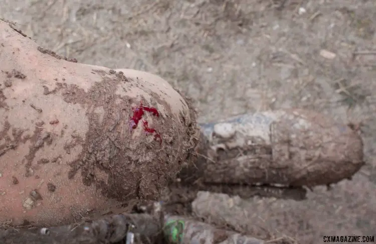 Gage Hecht's Nationals war wound. 2016 Cyclocross Nationals & Worlds bikes. © Cyclocross Magazine