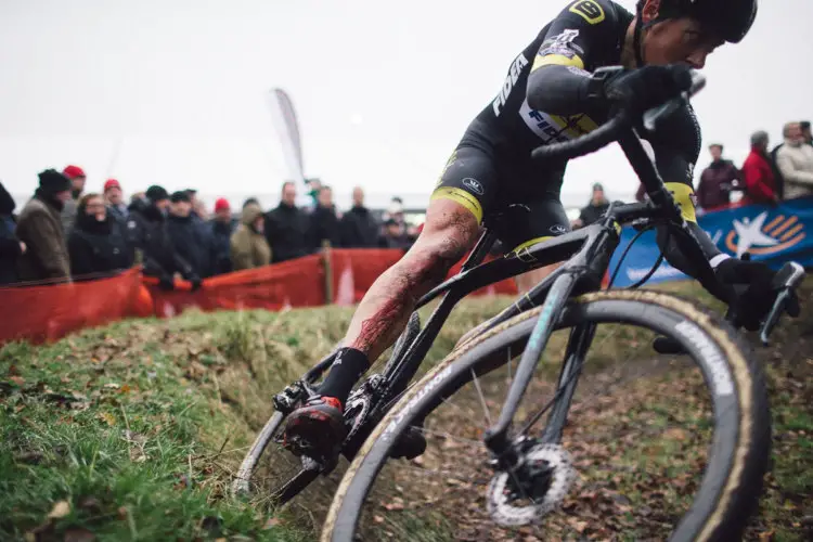 Some of the scars of the trade. Cyclocross DVV Verzekeringen Trofee #4 - Essen. © B. Hamvas / cyclephotos.co.uk