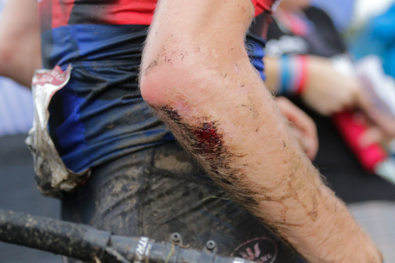 The slippery pavement turn at the bottom of the off-camber took its toll. 2021 UCI Cyclocross World Cup Waterloo, Elite Men. © D. Mable / Cyclocross Magazine